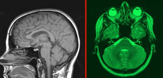 3256267450_f06ef28e36_z